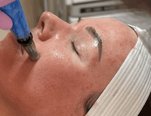 The Benefits of Microneedling at 901 Aesthetics