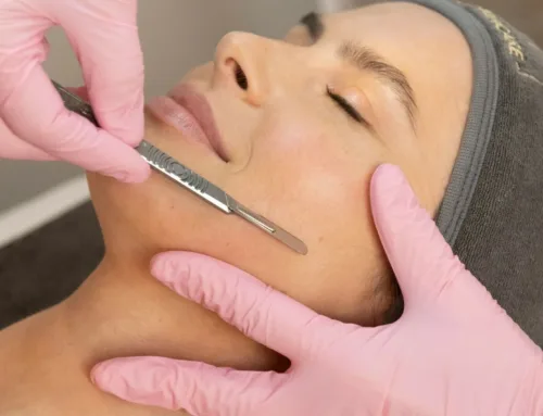 Unveil Smooth Skin with the Dermablade Facial at 901 Aesthetics