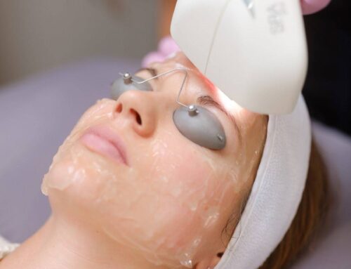 Illuminate Your Skin with the IPL Photofacial at 901 Aesthetics