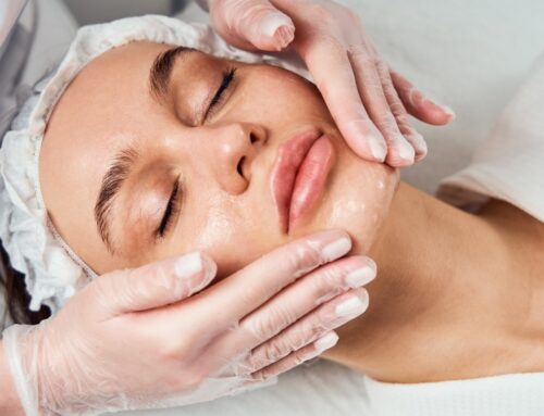 Chemical Face Peel In Arlington TN