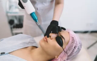 Can Laser Treatment Remove Acne Scars Permanently Results, Limits, and Best Options