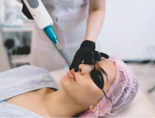 Can Laser Treatment Remove Acne Scars Permanently? Results, Limits, and Best Options